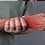 Wrist Pain